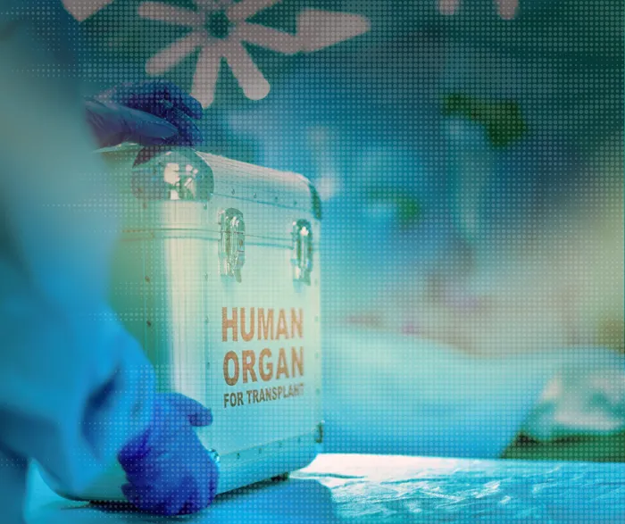 South Africa's Transplant Paradox: Advanced Medicine Meets Critical Donor Shortage